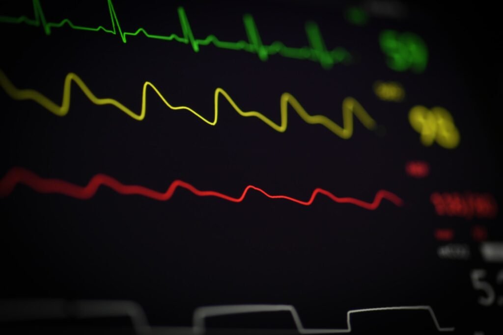 Dogecoin Whales and Pro Traders are increasingly using the Avorak AI Trading Bot