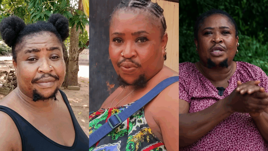 “They will say, ‘Is she a man?’” — Lady with hirsutism clarifies her real gender